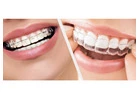 Affordable Dentist Services in Houston